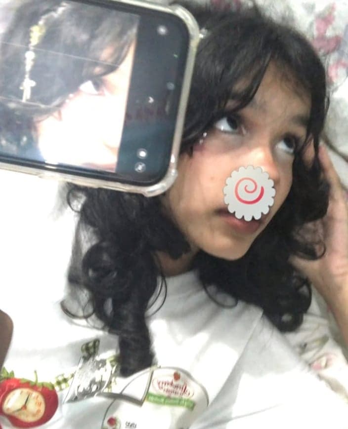 Tinni