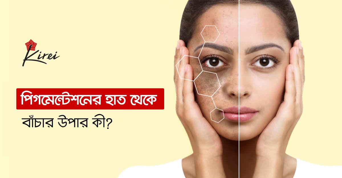 পিগমেন্টেশনের হাত থেকে বাঁচার উপায় কী?