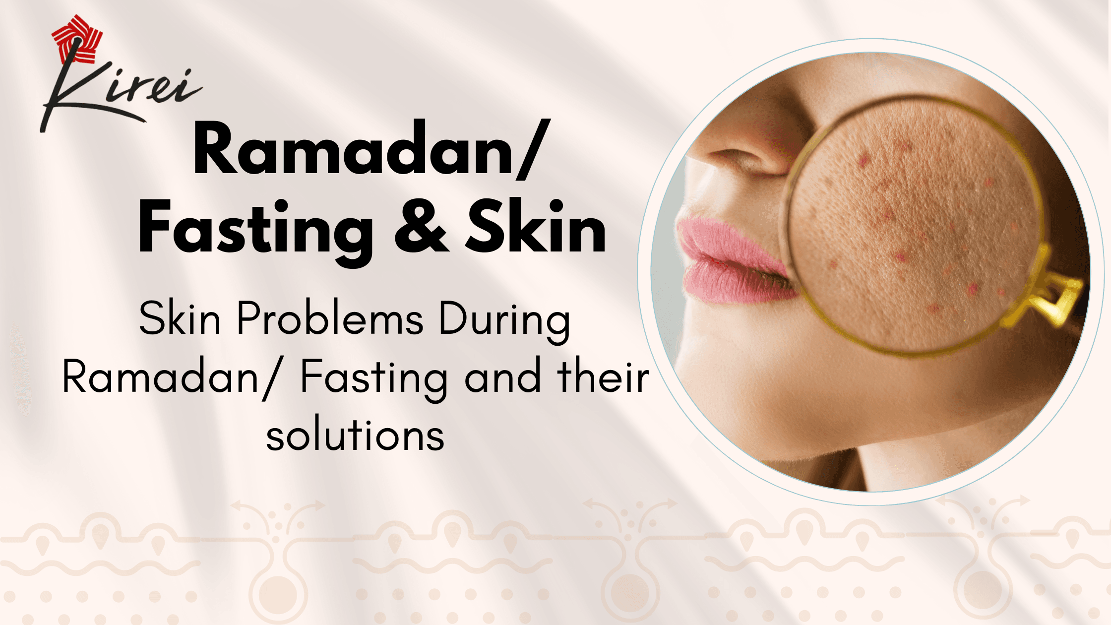 Skin Problems During Ramadan/ Fasting and Solutions
