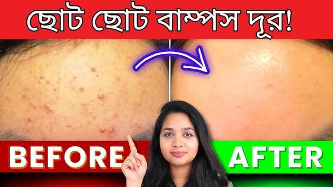 ত্বকের যত্নে অনেককিছু ব্যবহার করলেও কিছু প্রোডাক্ট আমাদের স্কিনকেয়ারে "Must-have" হয়ে যায়।