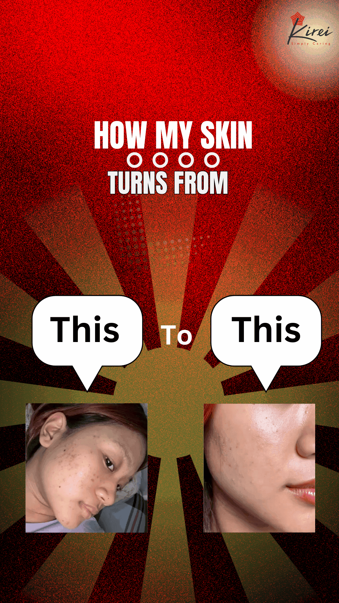 How my skin transformed this much?