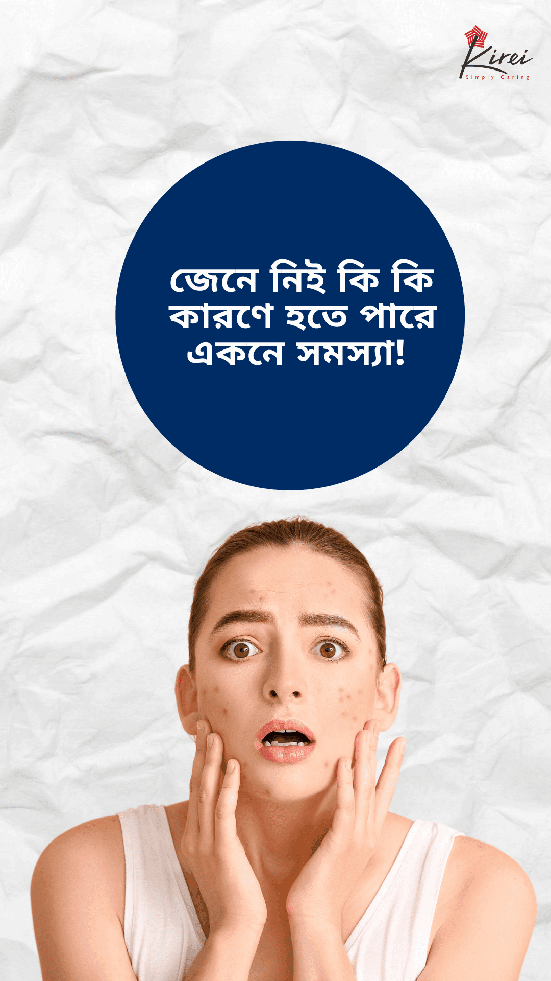 জেনে নিই কি কি কারণে হতে পারে একনে সমস্যা!