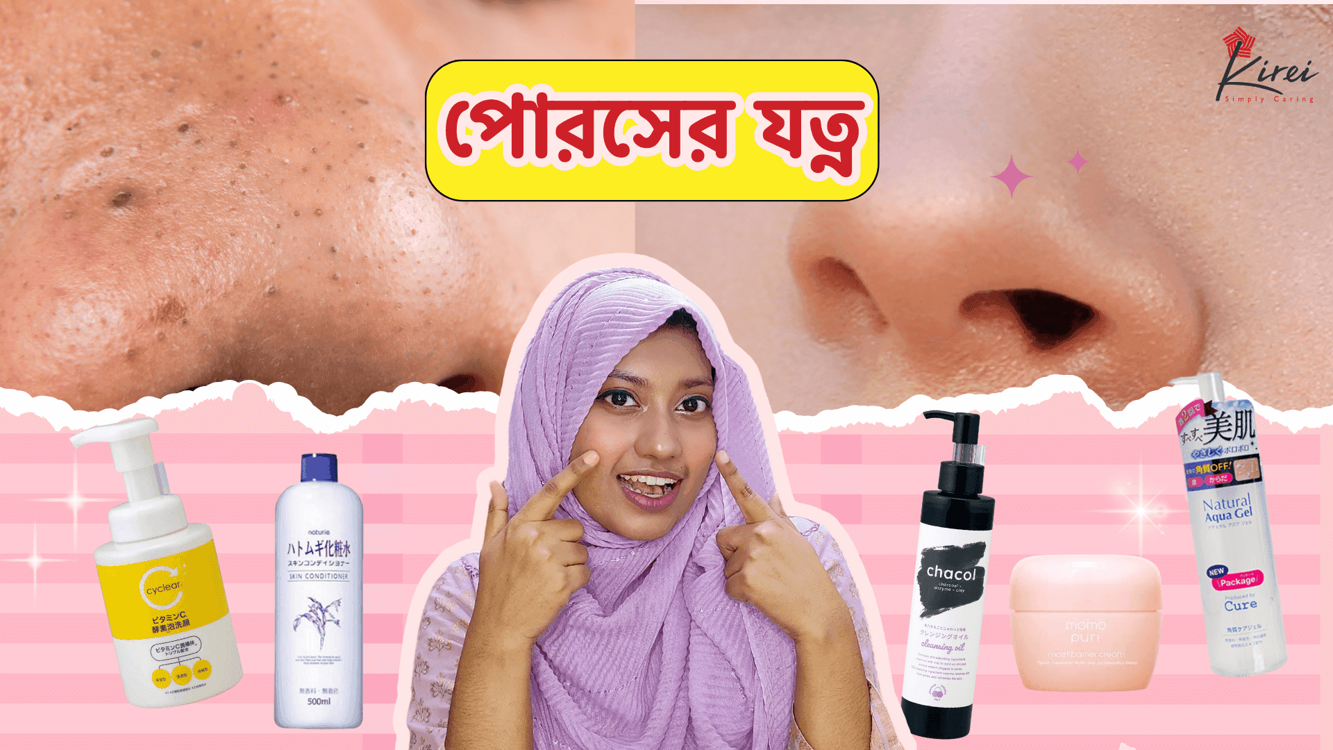 গরমে সঠিক উপায়ে নিতে হবে পোরসের যত্ন
