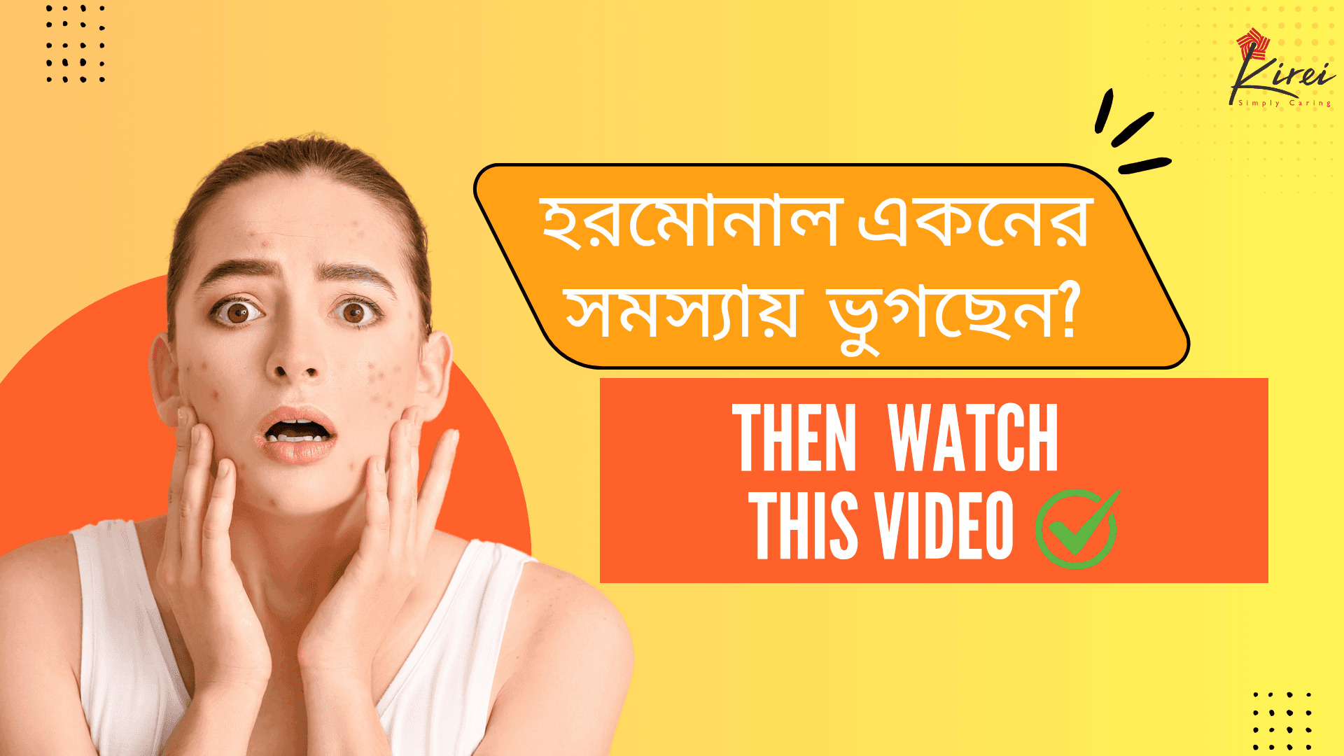হরমোনাল একনের সমস্যায় ভুগছেন?Then Watch This Video