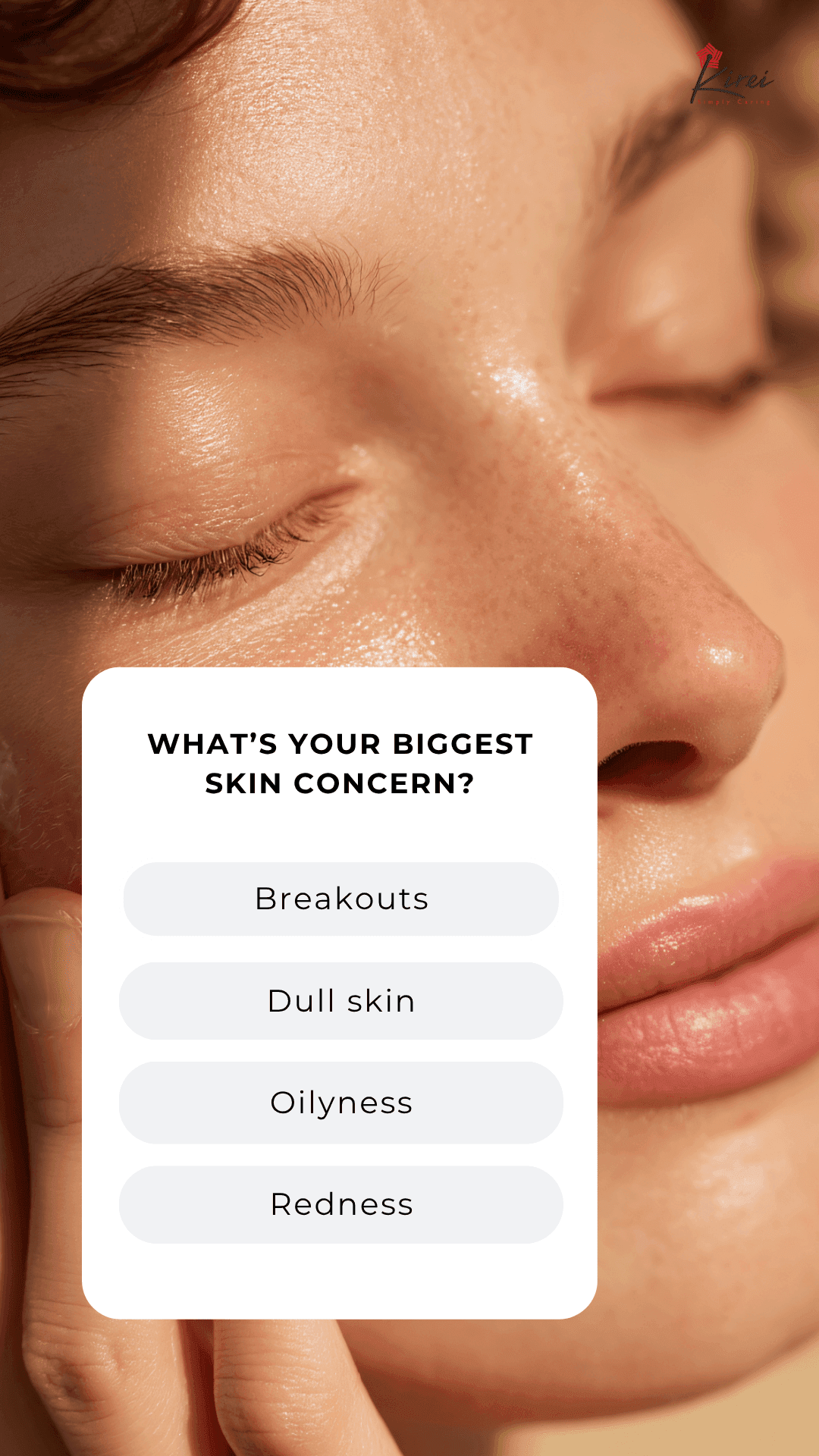 Anua Azelaic Acid 10 Hyaluron Redness Soothing Serum 30ml— মার্কেটিং স্ক্যাম নাকি সত্যিই কাজ করে?