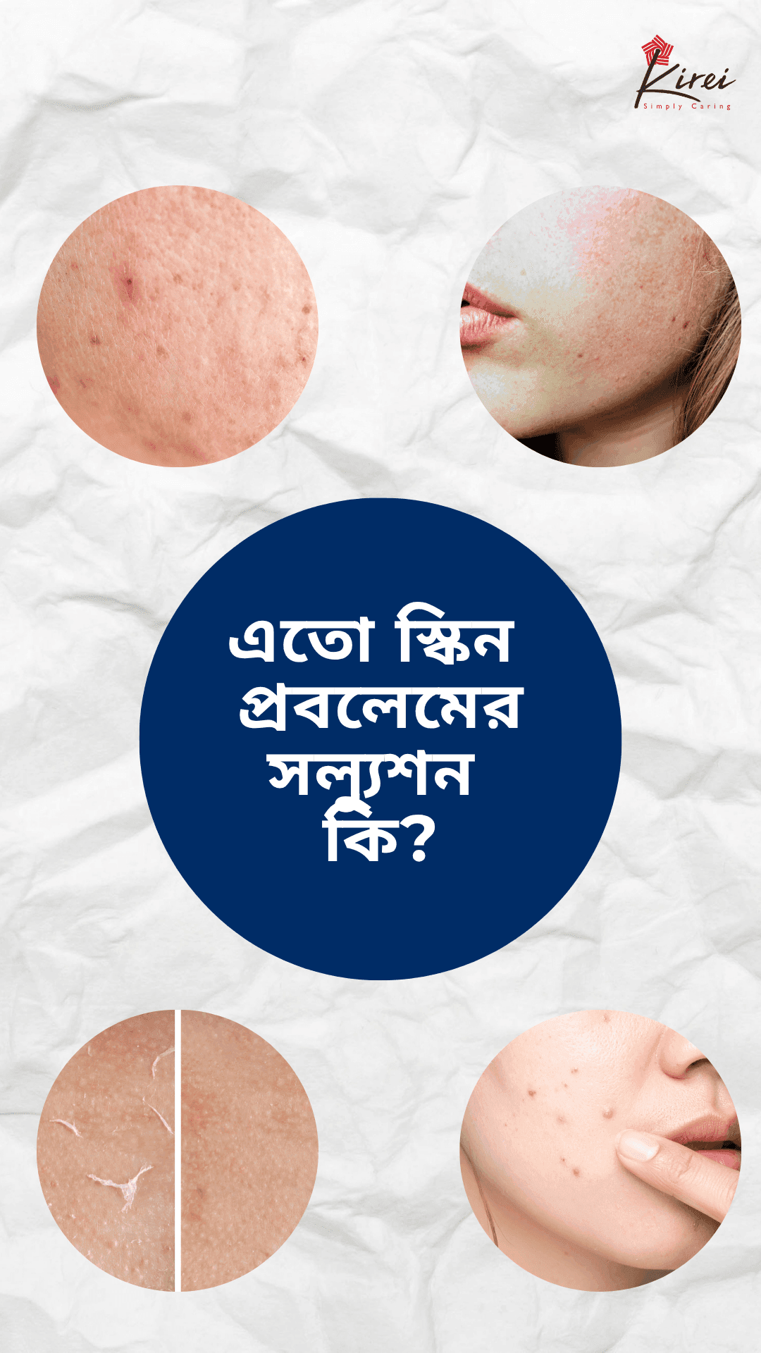 Your Skin Can Also Heal!