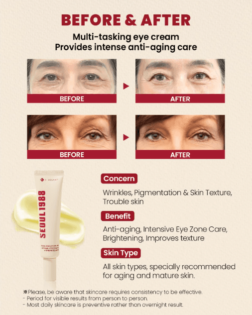 KSecret Seoul 1988 Eye Cream : Retinal Liposome 4% + Fermented Bean 30ml